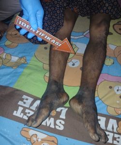 Polsek Perbaungan Cek TKP Penemuan Mayat Pria di Pajak Baru Sergai